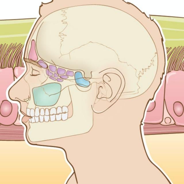 Acute and Chronic Rhinosinusitis: A Comprehensive Review (Coursera)